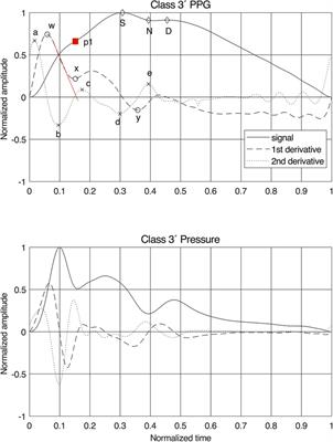 Estimation of aortic stiffness by finger photoplethysmography using enhanced pulse wave analysis and machine learning